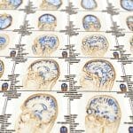 depressione resistente al trattamento