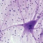 Nervous Tissue: Spinal Cord Motor Neuron
