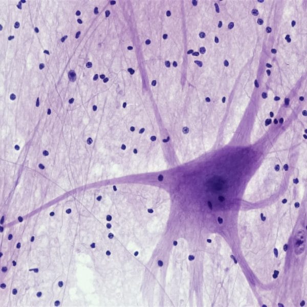 Nervous Tissue: Spinal Cord Motor Neuron